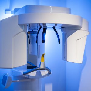 3D Röntgen DVT 3D Röntgen DVT